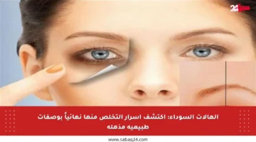 الهالات السوداء: اكتشف أسرار التخلص منها نهائياً بوصفات طبيعية مذهلة